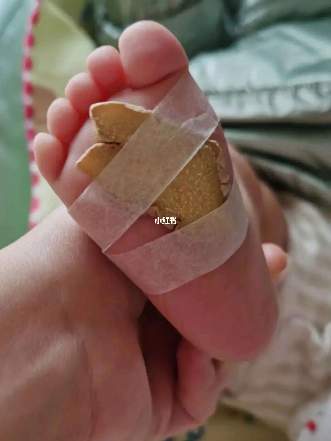 生姜怎么抹脚心