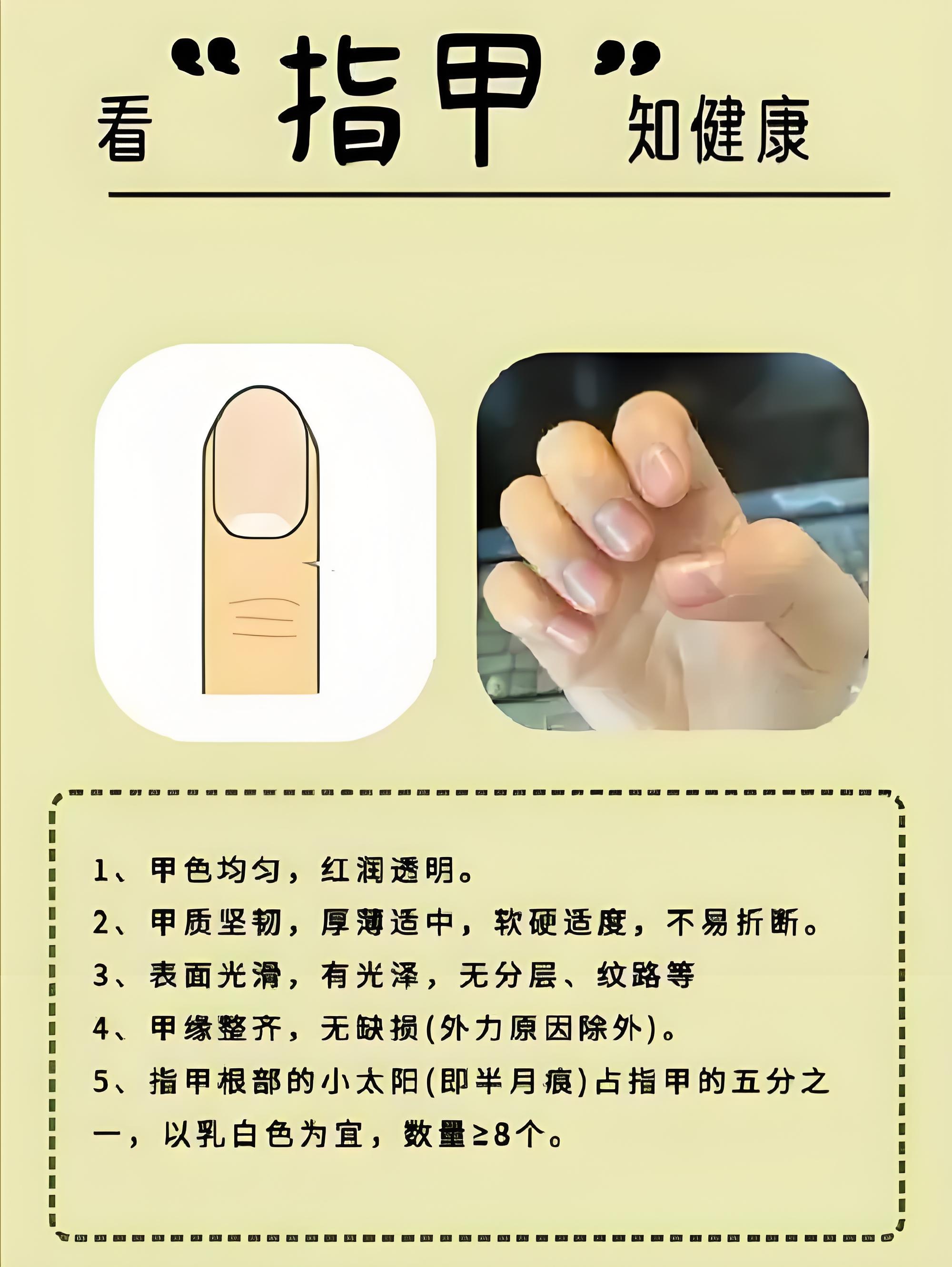 甲是什么偏旁
