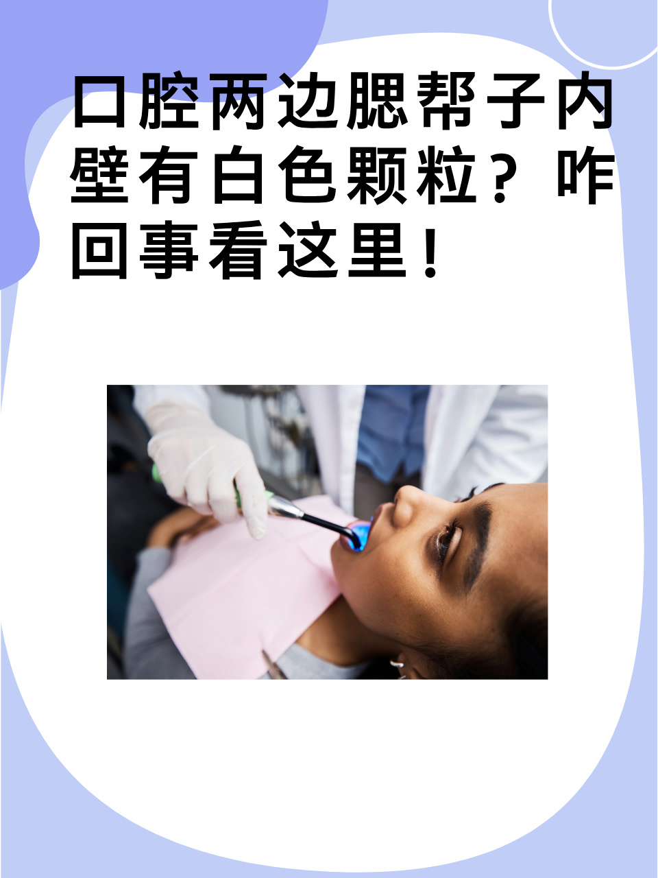 腮帮是哪里
