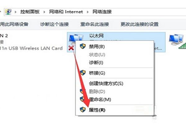 无法获取ip地址怎么办