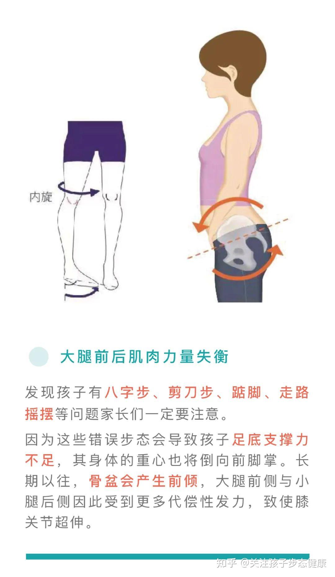 什么是剪刀步