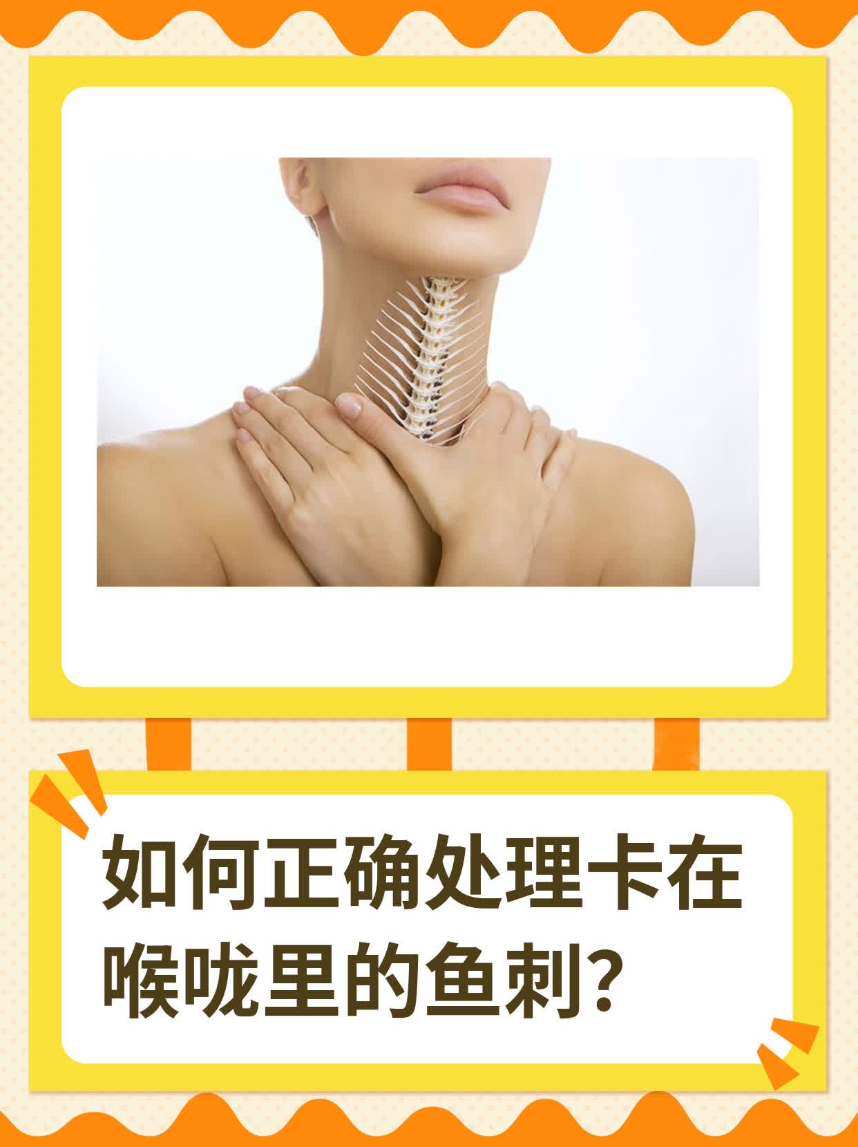 被鱼刺卡住了该怎么做